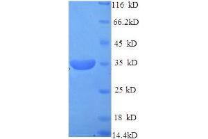 SDS-PAGE (SDS) image for N-Methylpurine-DNA Glycosylase (MPG) (AA 13-298), (partial) protein (His tag) (ABIN5713660)