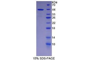 SDS-PAGE analysis of Human NFkB2 Protein. (Nuclear Factor kappa B2 Protéine)