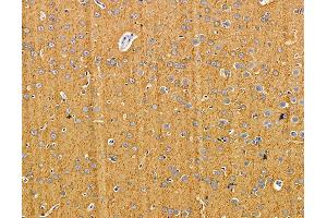 ABIN7095870 and ABIN7099932 at 1/100 staining rat brain tissue by IHC-P.