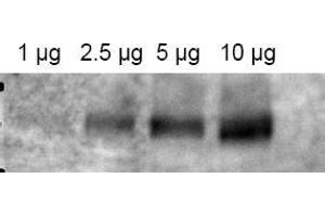 Image no. 1 for anti-ATP-Binding Cassette, Sub-Family B (MDR/TAP), Member 1 (ABCB1) (AA 262-277) antibody (ABIN401371) (ABCB1 anticorps  (AA 262-277))