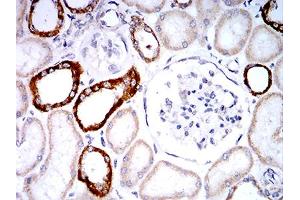 Immunohistochemistry (IHC) image for anti-Phospholipase D2 (PLD2) (AA 834-933) antibody (ABIN5881791) (Phospholipase D2 anticorps  (AA 834-933))