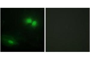 Immunofluorescence analysis of HeLa cells, using DAXX Antibody.