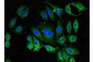 Immunofluorescent analysis of A549 cells using ABIN7145258 at dilution of 1:100 and Alexa Fluor 488-congugated AffiniPure Goat Anti-Rabbit IgG(H+L)