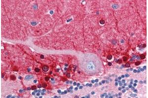 Human Brain, Cerebellum (formalin-fixed, paraffin-embedded) stained with AMPH antibody ABIN351482 at 2. (Amphiphysin anticorps  (AA 159-170))