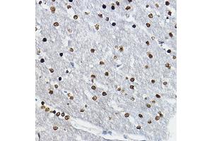 Immunohistochemistry of paraffin-embedded rat brain using SOX10 Rabbit pAb (ABIN6134484, ABIN6148289 and ABIN7101829) at dilution of 1:100 (40x lens). (SOX10 anticorps)
