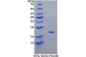 SDS-PAGE analysis of Mouse MIg Protein.