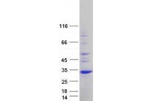 Validation with Western Blot