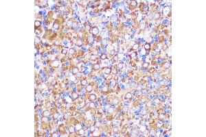 Immunohistochemistry of paraffin-embedded Rat ovary using NEK9 antibody (ABIN7268914) at dilution of 1:100 (40x lens).