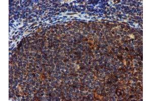 Image no. 13 for anti-Sepiapterin Reductase (SPR) antibody (ABIN1501115)