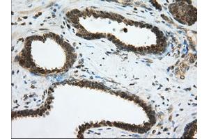 Immunohistochemical staining of paraffin-embedded Human pancreas tissue using anti-PDE4A mouse monoclonal antibody. (PDE4A anticorps)