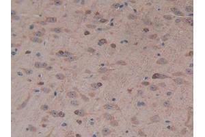 Detection of UCN2 in Mouse Cerebrum Tissue using Polyclonal Antibody to Urocortin 2 (UCN2)