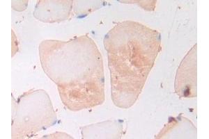 Detection of ADPN in Rat Skeletal muscle Tissue using Polyclonal Antibody to Adiponectin (ADPN) (ADIPOQ anticorps  (AA 111-244))