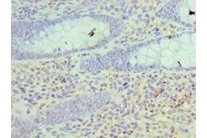 Immunohistochemistry of paraffin-embedded human epityphlon tissue using ABIN7162980 at dilution of 1:100 (HSD17B4 anticorps  (AA 437-736))