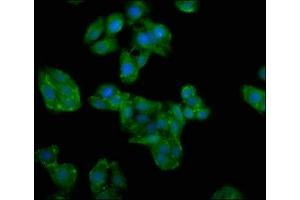 Immunofluorescence staining of HepG2 cells with ABIN7154621 at 1:100, counter-stained with DAPI. (GIMAP4 anticorps  (AA 5-101))
