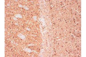 CASK Immunohistochemistry.