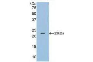 Detection of Recombinant DUSP3, Human using Polyclonal Antibody to Dual Specificity Phosphatase 3 (DUSP3) (Dual Specificity Phosphatase 3 (DUSP3) (AA 2-185) anticorps)