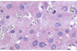 Immunohistochemical (Formalin/PFA-fixed paraffin-embedded sections) staining in human ovary with PTGFR polyclonal antibody . (PTGFR anticorps  (2nd Cytoplasmic Domain))