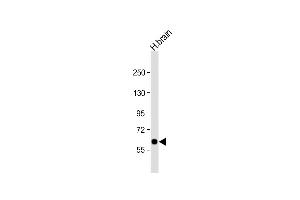 Anti-SLC2A13 Antibody (Center) at 1:1000 dilution + human brain lysate Lysates/proteins at 20 μg per lane. (SLC2A13 anticorps  (AA 268-297))