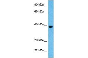 Host:  Rat  Target Name:  FOS  Sample Tissue:  Rat Liver  Antibody Dilution:  1ug/ml