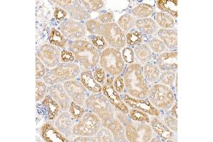 Immunohistochemistry of paraffin-embedded mouse kidney using KRAS Rabbit pAb (ABIN3021676, ABIN3021677, ABIN3021678, ABIN1513137 and ABIN1514282) at dilution of 1:150 (40x lens). (K-RAS anticorps)