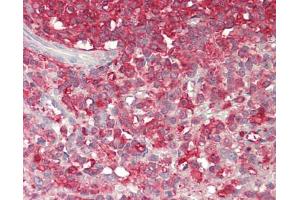 Human Spleen: Formalin-Fixed, Paraffin-Embedded (FFPE).