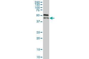 RBM9 monoclonal antibody (M02), clone 5E11 Western Blot analysis of RBM9 expression in A-431 . (RBM9 anticorps  (AA 1-100))