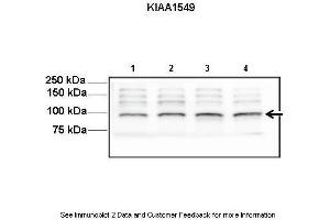 Lanes:   Lane1-4: 30ug mouse neurosphere lysate  Primary Antibody Dilution:   1:1000  Secondary Antibody:   Anti-rabbit HRP  Secondary Antibody Dilution:   1:5000  Gene Name:   KIAA1549  Submitted by:   Yi-Hsien Chen, Washington University School of Medicine (KIAA1549 anticorps  (C-Term))