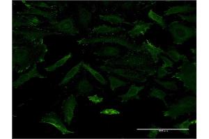 Immunofluorescence of monoclonal antibody to MAGI1 on HeLa cell. (MAGI1 anticorps  (AA 761-859))