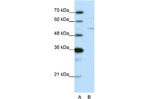 WB Suggested Anti-HNRPK Antibody Titration:  0. (HNRNPK anticorps  (N-Term))