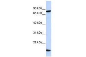 Image no. 1 for anti-Zinc Finger Protein 281 (ZNF281) (C-Term) antibody (ABIN6740570) (ZNF281 anticorps  (C-Term))