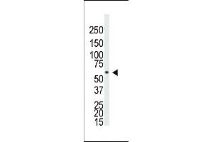 Western blot analysis of anti-BR1A Pab ap2004a in Saos-2 cell lysate.