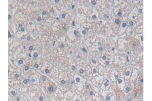 Detection of DSP in Human Liver Tissue using Polyclonal Antibody to Desmoplakin (DSP)