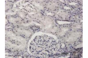 Image no. 1 for anti-PR Domain Containing 4 (PRDM4) (AA 476-576) antibody (ABIN599168)