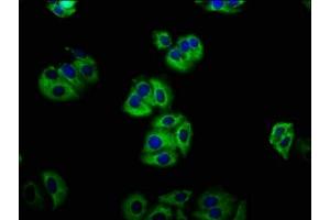 Immunofluorescence staining of HepG2 cells with ABIN7158130 at 1:133, counter-stained with DAPI.