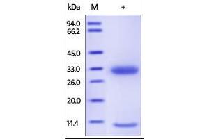 Human FcRn / FCGRT & B2M on SDS-PAGE under reducing (R) condition. (FcRn Protein (AA 24-297) (His tag,Strep Tag))