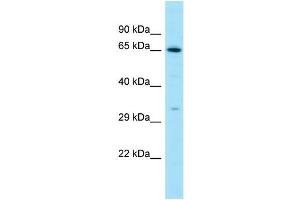 Western Blotting (WB) image for anti-Luteinizing Hormone/Choriogonadotropin Receptor (LHCGR) (C-Term) antibody (ABIN2788657) (LHCGR anticorps  (C-Term))