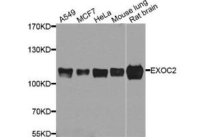 Western blot analysis of extract of various cells, using EXOC2 antibody. (EXOC2 anticorps)