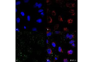 Immunocytochemistry/Immunofluorescence analysis on permeabilized HCT116 cells using Mouse Anti-HSP70 Monoclonal Antibody, Clone 1H11: FITC conjugate  showing faint cell membrane and intracellular staining.