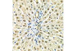 Immunohistochemistry of paraffin-embedded Rat liver using HNRNPA2B1 antibody at dilution of 1:100 (x400 lens). (HNRNPA2B1 anticorps  (AA 1-180))