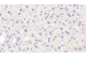 Detection of LOXL2 in Mouse Liver Tissue using Polyclonal Antibody to Lysyl Oxidase Like Protein 2 (LOXL2)