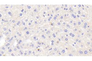 Detection of LOXL2 in Mouse Liver Tissue using Polyclonal Antibody to Lysyl Oxidase Like Protein 2 (LOXL2) (LOXL2 anticorps  (AA 53-160))