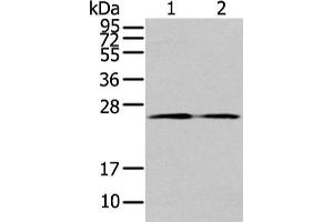 Gel: 12 % SDS-PAGE, Lysate: 40 μg, Lane 1-2: PC3 cell and human colon cancer tissue, Primary antibody: ABIN7192958(TUSC1 Antibody) at dilution 1/200 dilution, Secondary antibody: Goat anti rabbit IgG at 1/8000 dilution, Exposure time: 1 minute (TUSC1 anticorps)