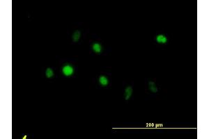 Immunofluorescence of monoclonal antibody to ANXA5 on HeLa cell. (Annexin V anticorps  (AA 1-320))