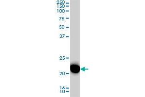 RRAS monoclonal antibody (M01), clone 2E12 Western Blot analysis of RRAS expression in HeLa .