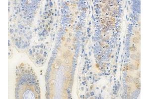 ABIN6258278 and ABIN6273860 at 1/100 staining human normal colon tissue by IHC-P. (GPR20 anticorps  (C-Term))