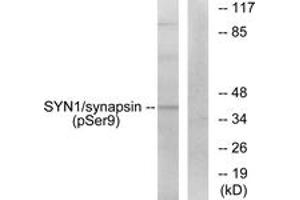 Western blot analysis of extracts from 293 cells treated with PMA 200nM 30', using Synapsin (Phospho-Ser9) Antibody. (SYN1 anticorps  (pSer9))