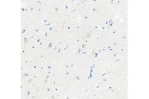 IHC analysis of FLIP/CFLAR using anti-FLIP/CFLAR antibody (ABIN5693075). (FLIP anticorps  (AA 1-376))
