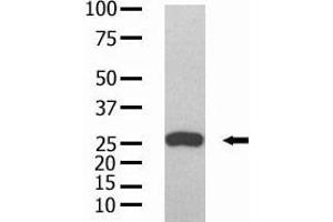 The anti-GST Mab (ABIN387751 and ABIN2843190) is used in Western blot to detect GST recombinant protein purified from bacterial lysate. (GST-Tag anticorps)