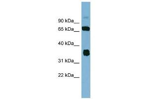 OSGEP antibody used at 1 ug/ml to detect target protein. (OSGEP anticorps  (Middle Region))