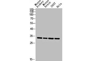 Western blot analysis of Mouse-kidney mouse-brain 293T hela lysis using CA II antibody. (CA2 anticorps  (C-Term))